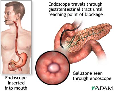 Procedure, part 1
