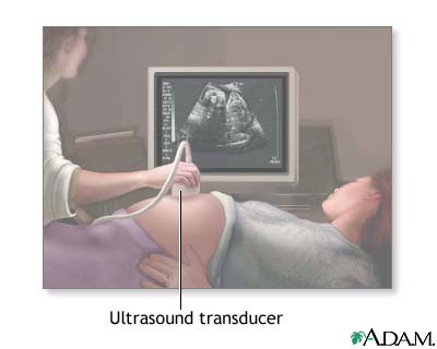 Procedure, part 1
