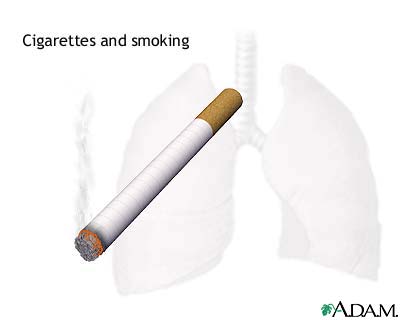Smoking hazards